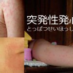 突発性発疹についてのまとめ